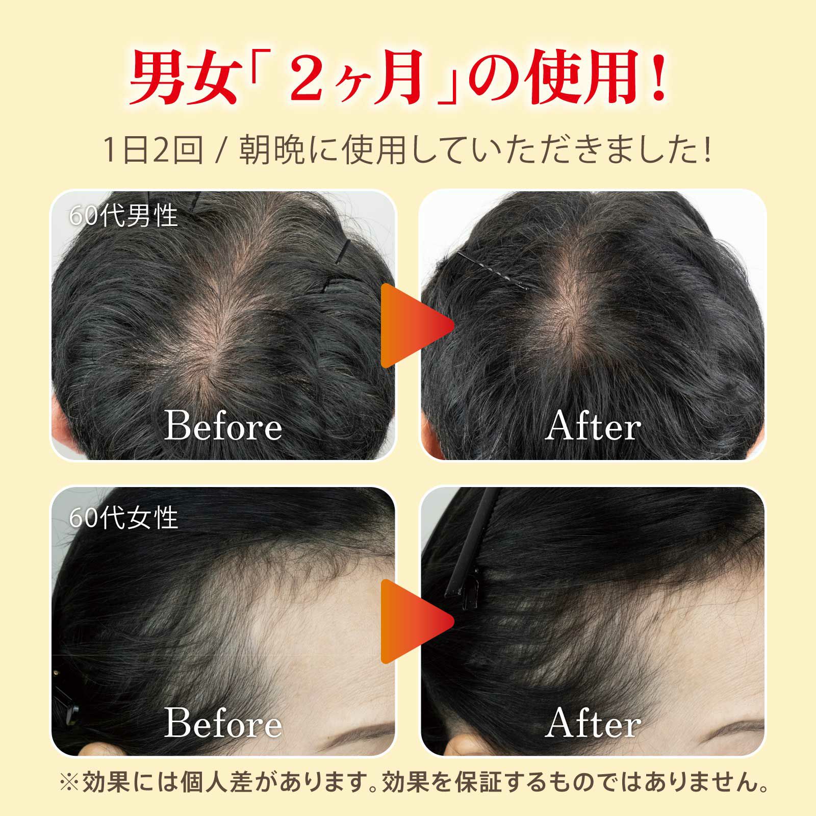 抜け毛対策