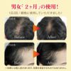 抜け毛対策